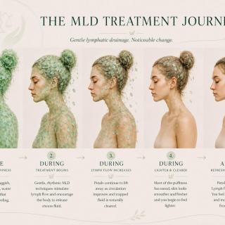 The MLD Treatment Journey ✨